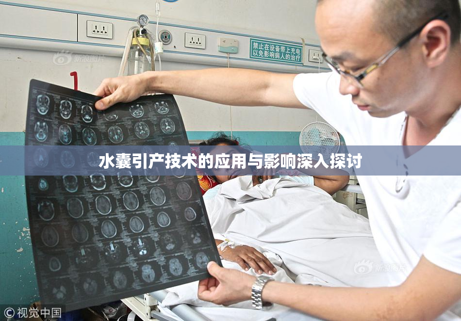 水囊引产技术的应用与影响深入探讨