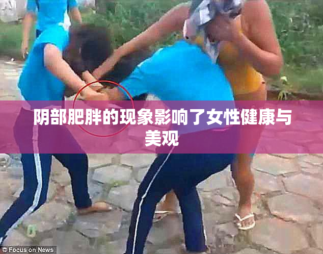 阴部肥胖的现象影响了女性健康与美观