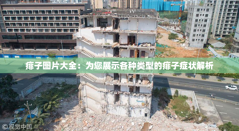 痱子图片大全：为您展示各种类型的痱子症状解析