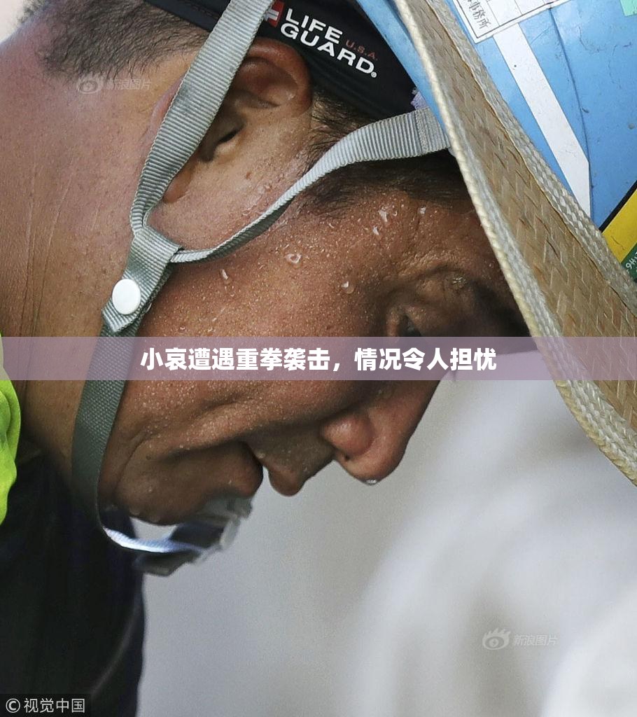 小哀遭遇重拳袭击，情况令人担忧