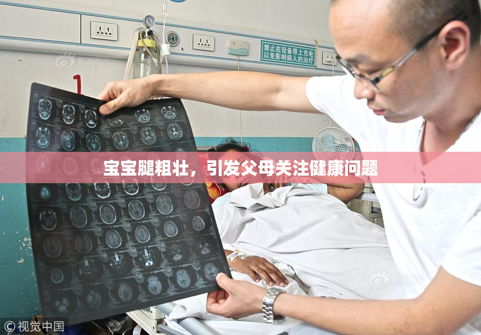 宝宝腿粗壮，引发父母关注健康问题