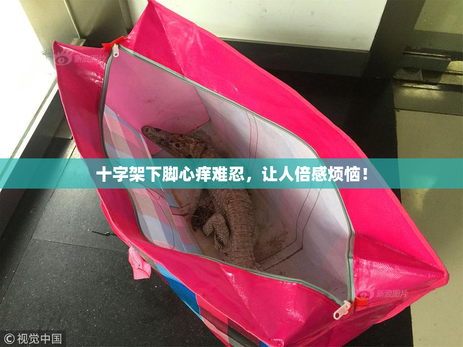 十字架下脚心痒难忍，让人倍感烦恼！