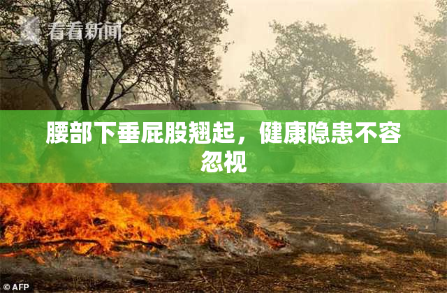 腰部下垂屁股翘起，健康隐患不容忽视