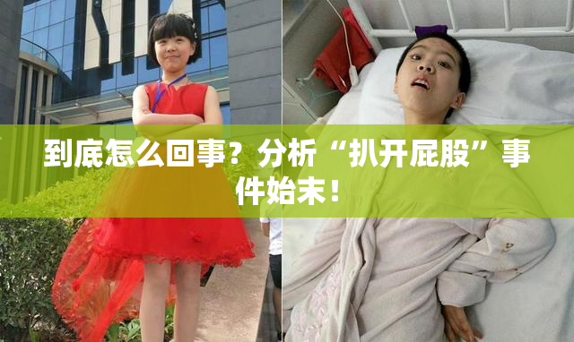 到底怎么回事？分析“扒开屁股”事件始末！