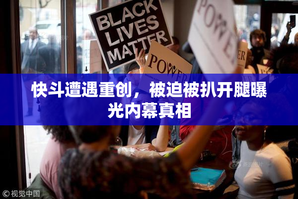 快斗遭遇重创，被迫被扒开腿曝光内幕真相