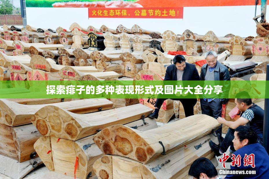探索痱子的多种表现形式及图片大全分享
