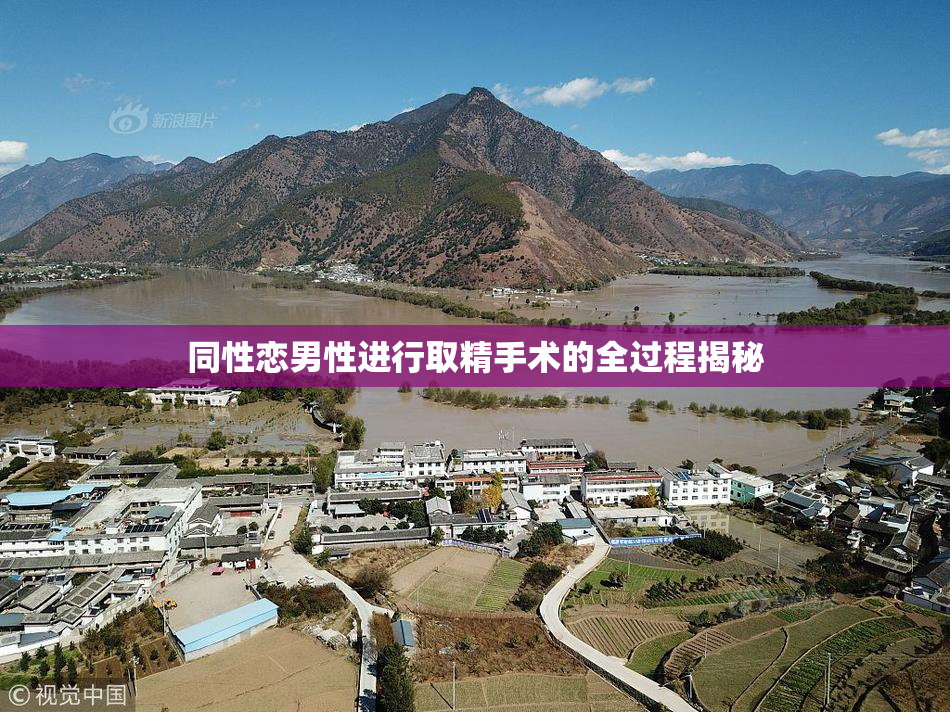 同性恋男性进行取精手术的全过程揭秘