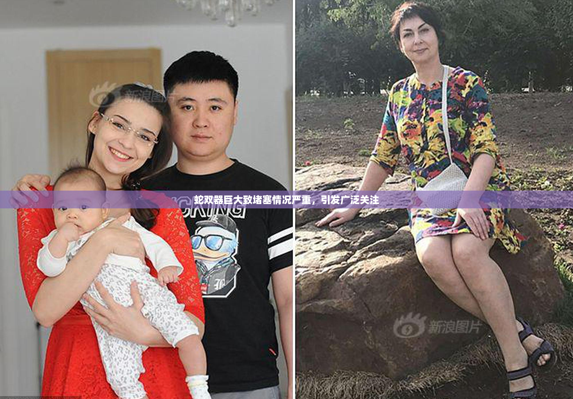 蛇双器巨大致堵塞情况严重，引发广泛关注