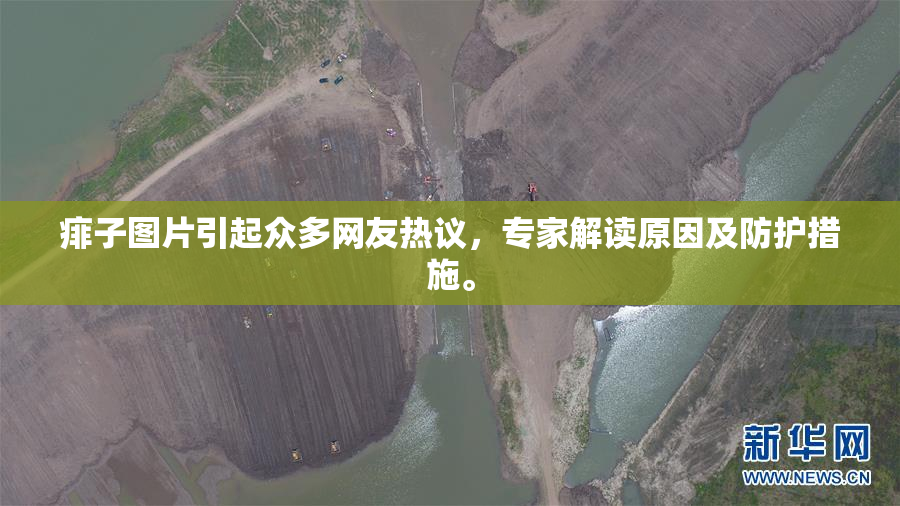 痱子图片引起众多网友热议，专家解读原因及防护措施。