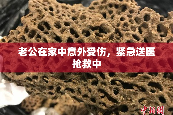 老公在家中意外受伤，紧急送医抢救中