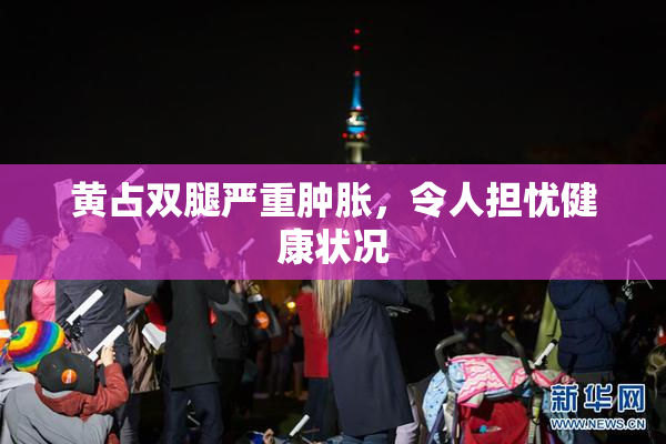 黄占双腿严重肿胀，令人担忧健康状况